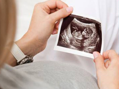 Süni mayalanma necə aparılır? Görüntülər yayıldı