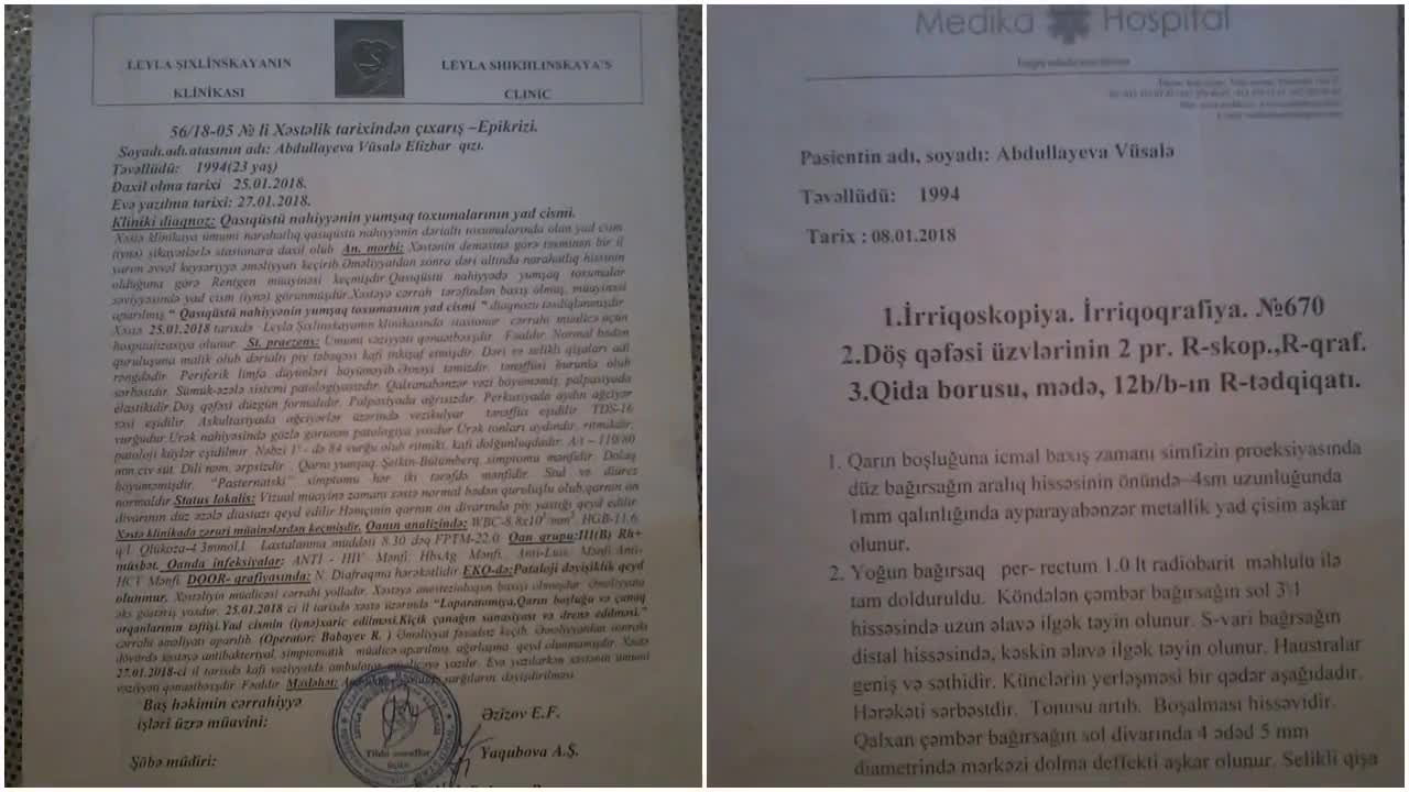 Azərbaycanda Dəhşət! : Həkim əməliyyat zamanı iynəni xəstənin qarnında qoydu..
